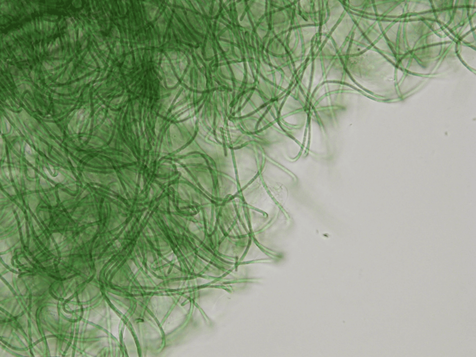 Il Percorso delle 4 Fasi: Come il Fango Termale Euganeo Trasforma il Benessere in Terapia Scientifica